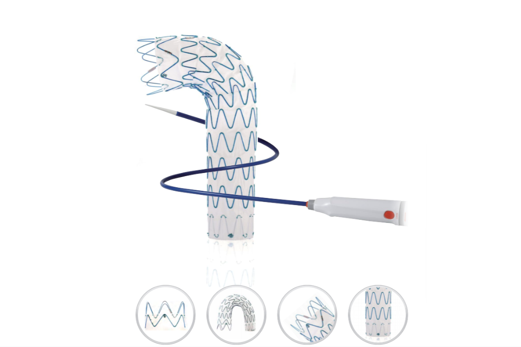 OEM Thoracic Aortic Stent Graft System Manufacturing: What Device Developers Need to Know OEM Thoracic Aortic Stent Graft System Manufacturing: What Device Developers Need to Know